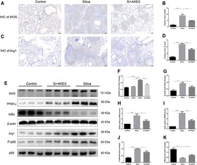 A Novel N-Arylpyridone Compound Alleviates the Inflammatory and Fibrotic Reaction of Silicosis by Inhibiting the ASK1-p38 Pathway and Regulating Macrophage Polarization